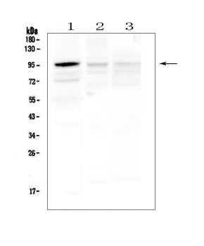 HECTD3 Rabbit Polyclonal Antibody