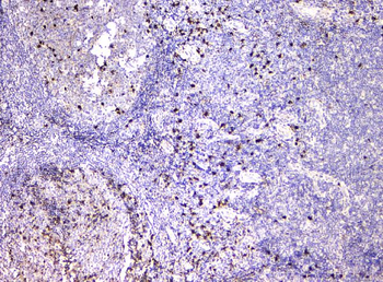 IGLL1 Rabbit Polyclonal Antibody