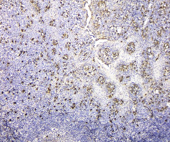 IGLL1 Rabbit Polyclonal Antibody