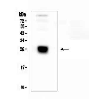 IGLL1 Rabbit Polyclonal Antibody
