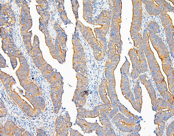 IQGAP1 Rabbit Polyclonal Antibody