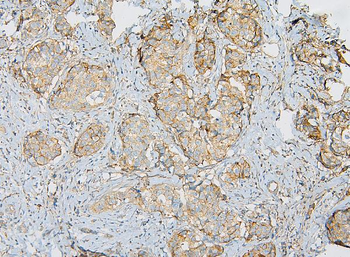 IQGAP1 Rabbit Polyclonal Antibody