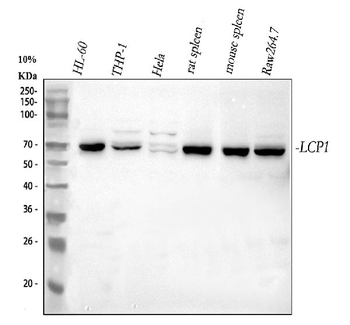 Plastin L/LCP1 Antibody