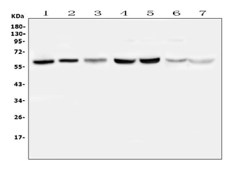 TPA Tissue Plasminogen Activator/PLAT Rabbit Polyclonal Antibody