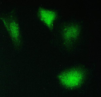 PPCS Rabbit Polyclonal Antibody