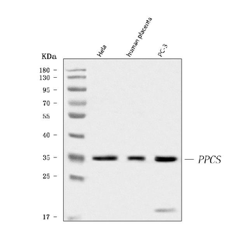 PPCS Rabbit Polyclonal Antibody