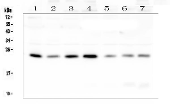 RAB11B Rabbit Polyclonal Antibody