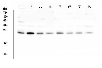RAB11B Rabbit Polyclonal Antibody