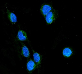 RHOB Rabbit Polyclonal Antibody