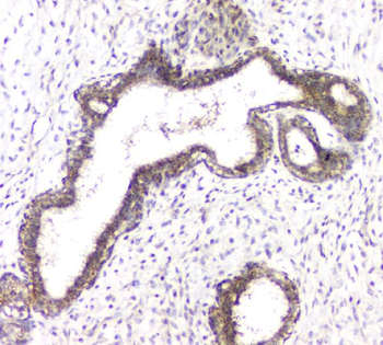 RHOB Rabbit Polyclonal Antibody