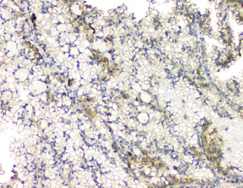 RHOB Rabbit Polyclonal Antibody