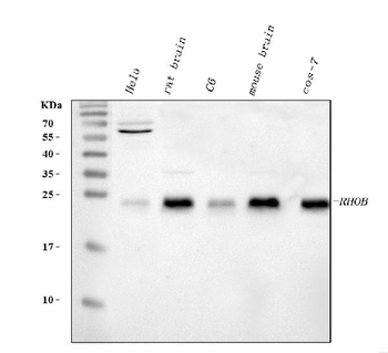 RHOB Rabbit Polyclonal Antibody