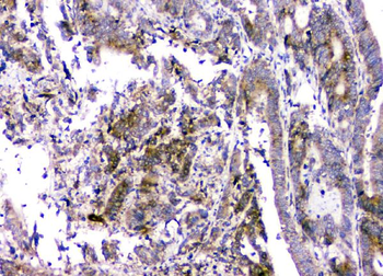 RMI2 Rabbit Polyclonal Antibody