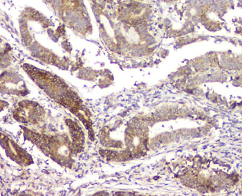 RMI2 Rabbit Polyclonal Antibody