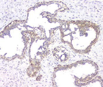 RMI2 Rabbit Polyclonal Antibody