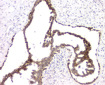 RMI2 Rabbit Polyclonal Antibody
