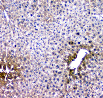 RMI2 Rabbit Polyclonal Antibody