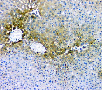 RMI2 Rabbit Polyclonal Antibody