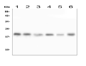 RMI2 Rabbit Polyclonal Antibody