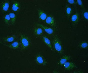 RRBP1 Rabbit Polyclonal Antibody