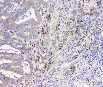 RRBP1 Rabbit Polyclonal Antibody