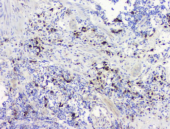 RRBP1 Rabbit Polyclonal Antibody