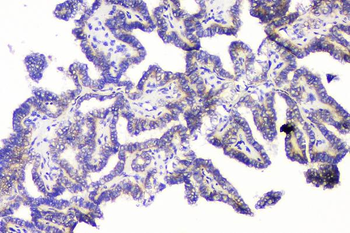RRBP1 Rabbit Polyclonal Antibody