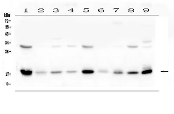 TIMM17A Rabbit Polyclonal Antibody