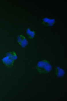 TIMM17A Rabbit Polyclonal Antibody