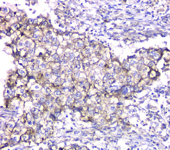 TIMM17A Rabbit Polyclonal Antibody