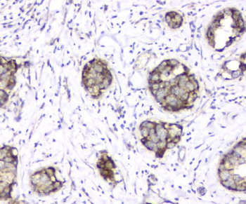 TIMM17A Rabbit Polyclonal Antibody