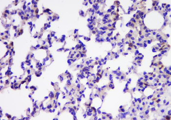 TIMM17A Rabbit Polyclonal Antibody
