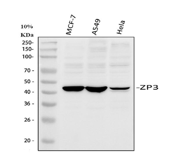 ZP3 Rabbit Polyclonal Antibody