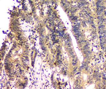 SHP2/PTPN11 Antibody (monoclonal, 2E6)