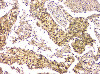 EIF6 Mouse Monoclonal Antibody