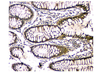 CA2 Mouse Monoclonal Antibody