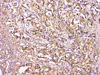 CA2 Mouse Monoclonal Antibody