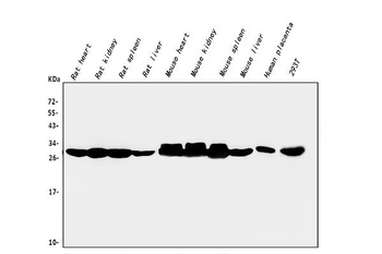 CA2 Mouse Monoclonal Antibody