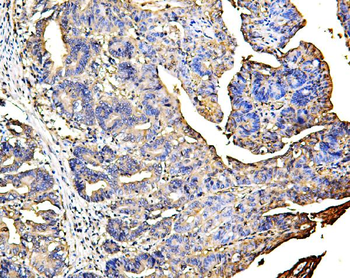 Galectin 3/LGALS3 Antibody (monoclonal, 12B12)