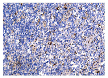 Galectin 3/LGALS3 Antibody (monoclonal, 12B12)