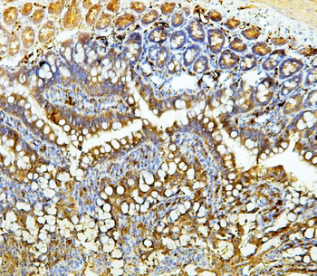 Galectin 3/LGALS3 Antibody (monoclonal, 12B12)