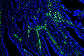 Caveolin-1/CAV1 Mouse Monoclonal Antibody