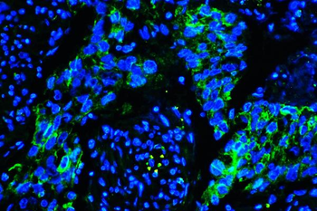 Caveolin-1/CAV1 Mouse Monoclonal Antibody