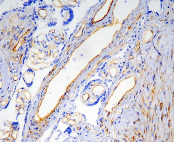 Caveolin-1/CAV1 Mouse Monoclonal Antibody