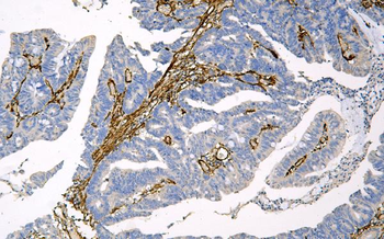 Caveolin-1/CAV1 Mouse Monoclonal Antibody