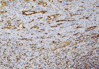 Caveolin-1/CAV1 Mouse Monoclonal Antibody