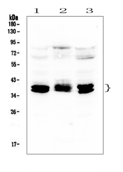 CXCR4 Rabbit Polyclonal Antibody