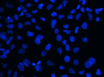 MECP2 Rabbit Polyclonal Antibody