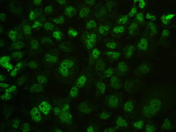 MECP2 Rabbit Polyclonal Antibody