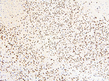 MECP2 Rabbit Polyclonal Antibody